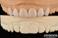 Propriété légère Prothèse flexible Finition personnalisée pour diverses spécifications