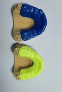 Advanced Orthodontic Retainer Expander For Precise And Comfortable Treatment