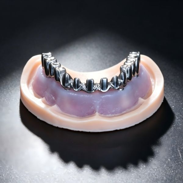 All On X Implant Titanium Bridge