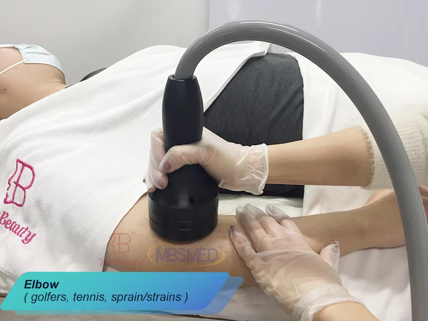 ESWT Мегковолновая электромагнитная сфокусированная машина для терапии ударными волнами