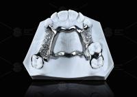 High Strength 3D Printed Titanium Framework With Clear Clasps For Durable Performance