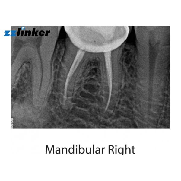 High Accuracy Dental X Ray Machine Portable Dental X Ray Unit 1 Year Warranty