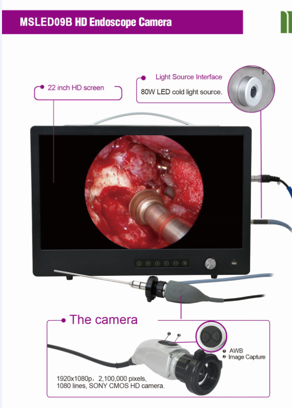 Portable Full HD Endoscope Camera For ENT Laparoscopy Hysteroscopy Cystoscopy Surgery Equipment