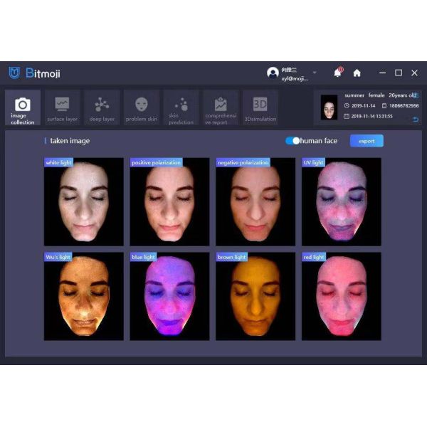 система анализатора кожи спектра Usb2.0 3d Dermatoscope 8