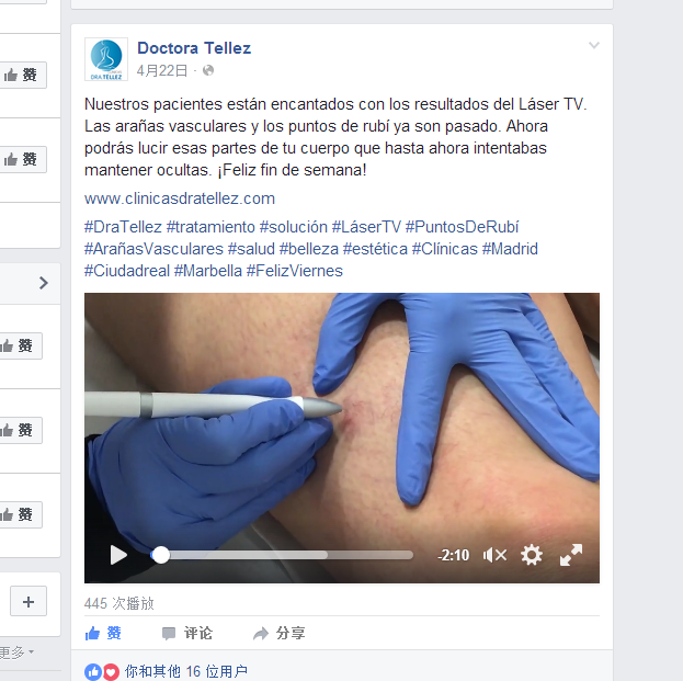 AC 30-150V Output voltage no harm to body laser treatment for veins on face laser equipment for spider veins