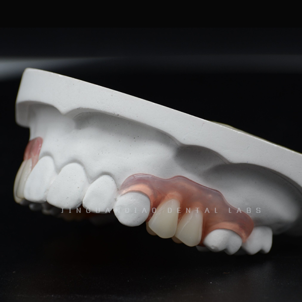 Customized Flexible Valplast Denture from China Dental Lab