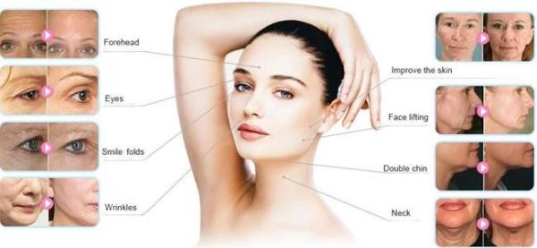 Multifunctional 4 Cartridge hifu machine / hifu face lift / hifu body slimming