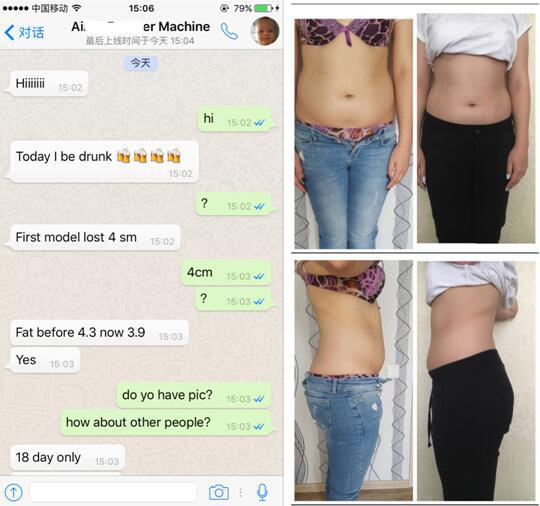 2016 newst!! -15oC 5 handles cryolipolysis fat reduction/ fat freezing slimming salon&clinic beauty machine with CE