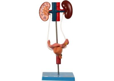 Female Urinary Organ Model With 30 Positions Display For Training