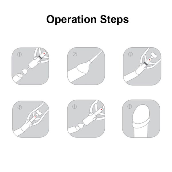 Trustworthy Disposable Circumcision Stapler Device Adult Male And Child Circumc Smart Clamp Kits Device