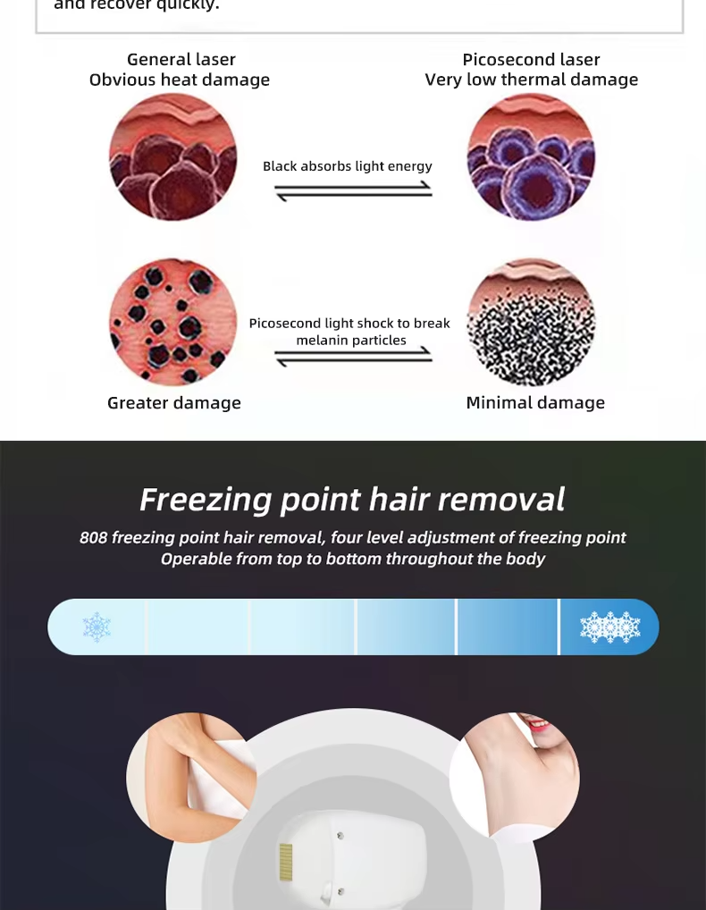 Pico Laser Nd Yag Carbon Peeling Tattoo Removal 808nm Diode Laser Hair Removal Machine