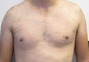 IPL hair removal,skin rejuvenation device,pigment removal equipment