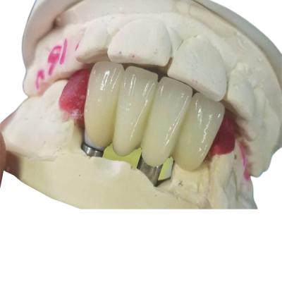 Strong Ti Base Milling Dental Implant Crowns Tooth Supported Bridge