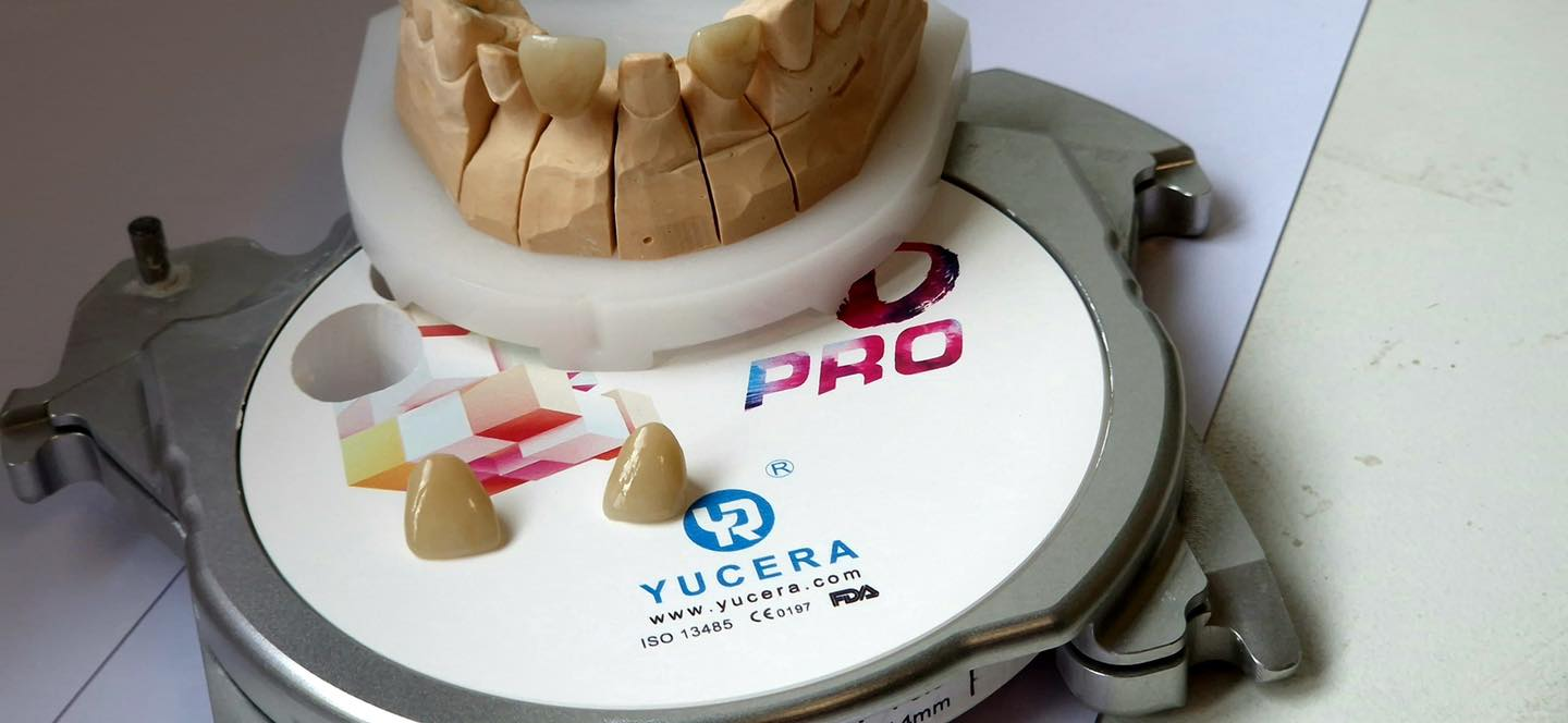 Yucera 4D Pro 95mm Dental Zirconia Block Precise Dimensions Suitable for a Variety of Dental Restoration Solutions
