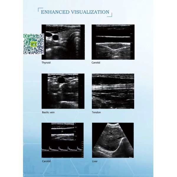 Hot Sale Smart USB Convex Medical Doppler Ultrasound Scanner Ultrasound Probe