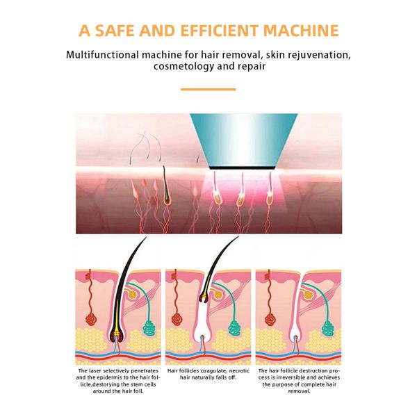 IPL Skin Rejuvenation Hair Removal Machine with Acne/Pigment/Wrinkle/Vascular Removal