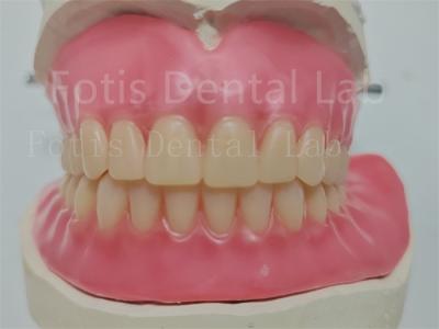 Affordable Custom Full Acrylic Denture With Ivoclar Teeth Easy To Use