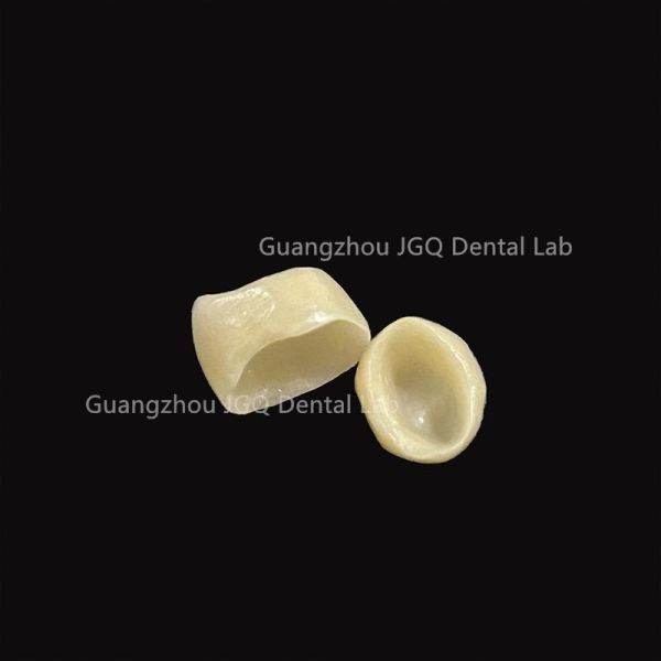 Long Lasting Zirconia Crown Bridge Precise Margin Adaptation for Dental Restoration