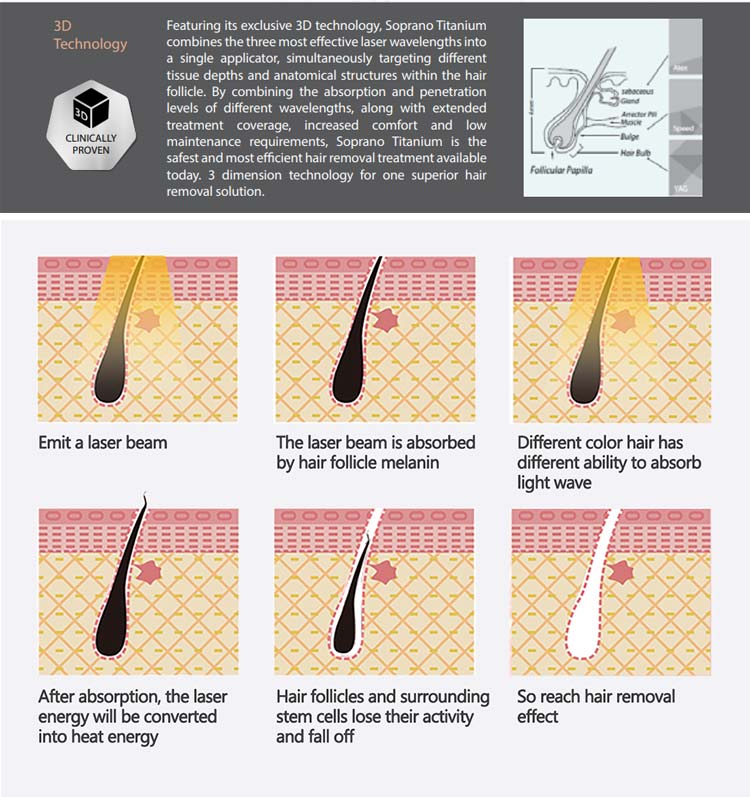 12HZ Laser Hair Removal Machine Painless 808nm For End User