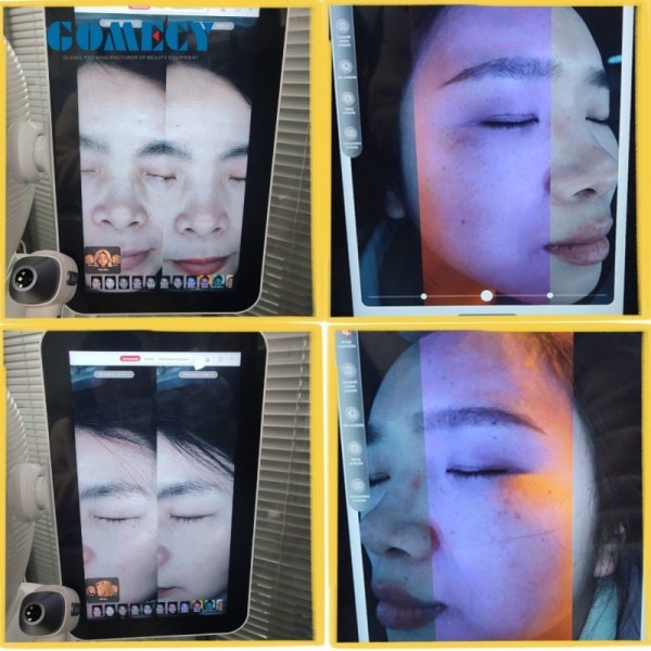 Facial Skin Analysis Machine Skin Moisture Tester Skin Analyzer Machine Hair Follicles Detector Beauty Salon Instrument