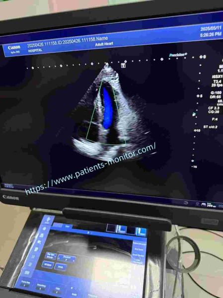 Toshiba PSI-30BX Phased Array Transducer A Used Medical Ultrasound Device With Milky-white Exterior And Real-Time Grating Lobe Suppression