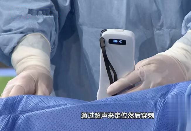 ультразвука кармана блока развертки ультразвука 5G Wifi заряжатель батареи лития 4200mAh Handheld встроенный беспроводной поддержал