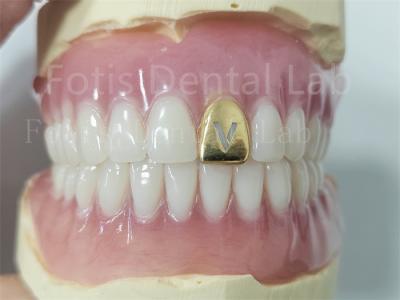 Comfortable Precision Fit Full Acrylic Denture Prosthesis With Natural Teeth