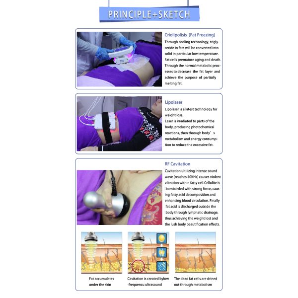 Cryo Cryolipolysis Slimming Cavitation Fat Loss Machine 4 In 1 Low Intensity