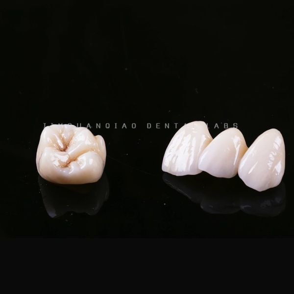 Custom Dental Lab Zirconia Crown Bridge Fabrication Stable Restoration