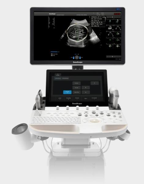 Artificial Intelligence Based SonoScape Ultrasound Machine Trolley P60 Exp