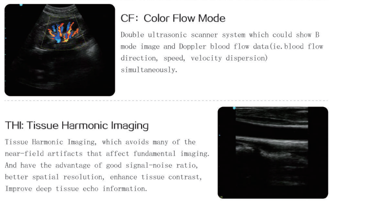 2d /3d/4d Medical Ultrasound Machine