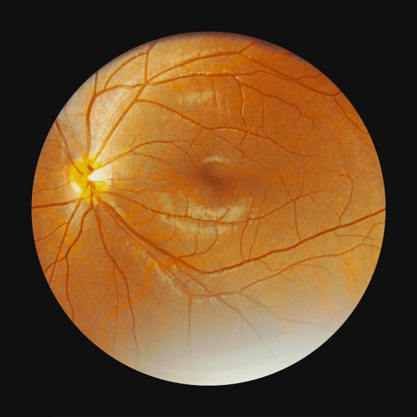 2022 year newest Manual auto focus portable handheld eye fundus camera HA11