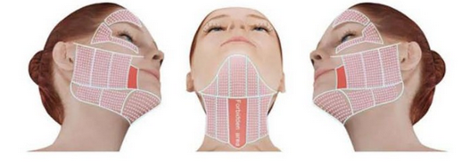 Professional HIFU Machine / Non Surgical Ultrasonic Face Lift Machine For Home