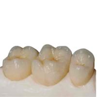 Precisão cerâmica Digital dos dentes da zircônia de grande resistência manufaturado
