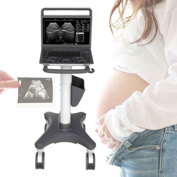 Sonoscape E2 Ecografo Cardiac Vascular Diagnosis B/ 2B/ 4B/ M/ Color Doppler Ultrasound Machine Requipo De Ultrasonido