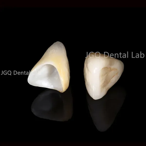 Customized Dental Crown and Bridge Porcelain Fused to Zirconia with CE FDA Certification and 3D Laser Printing