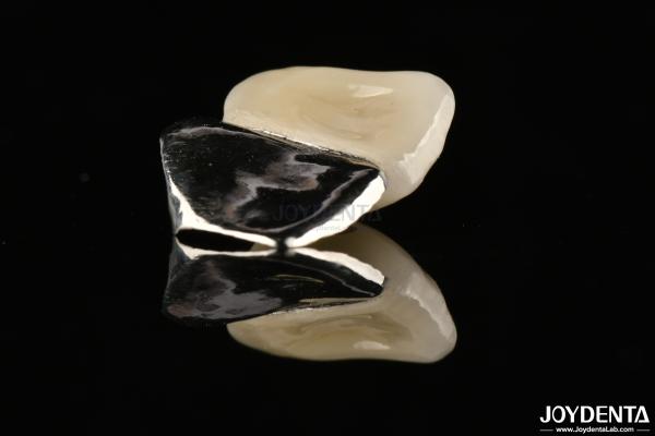 Metallic Dental Maryland Bridge Good Chewing Function For Long Lasting Remediation