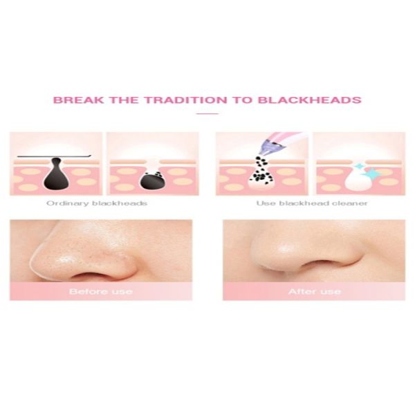 Pink Electric Blackhead Remover Machine Acne Vacuum Pores Cleaner ABS Material