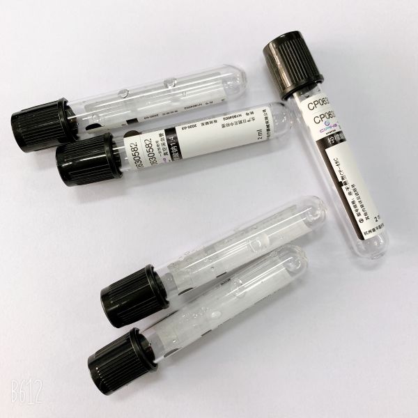 Антикоагулатион крови профессиональных трубок образца крови стерильный