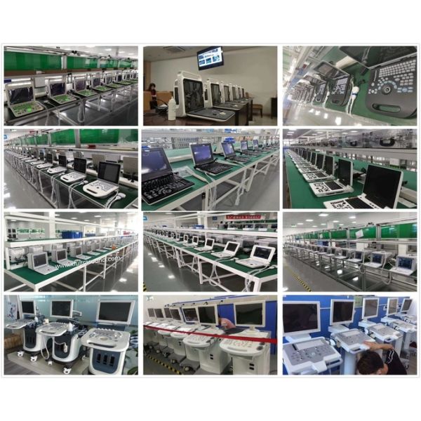 Оборудование ультразвука портативной беременности акушерское с линейным УПРАВЛЕНИЕМ ПО САНИТАРНОМУ НАДЗОРУ ЗА КАЧЕСТВОМ ПИЩЕВЫХ ПРОДУКТОВ И МЕДИКАМЕНТОВ зонда