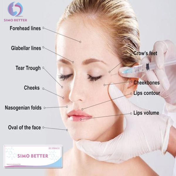 Non Surgical Breast Augmentation Fillers Hyaluronic Acid Wrinkle Fillers