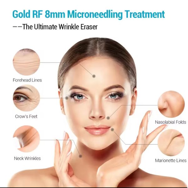 Venta caliente Fráctil RF Reducción de grasa del rostro levantamiento de la piel apretamiento Microneedle morpheus 8 máquina