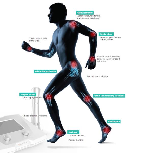 Extracorporal Shock Wave Therapy For Erectile Dysfunction Shockwave Therapy Back Pain Relief Equipment