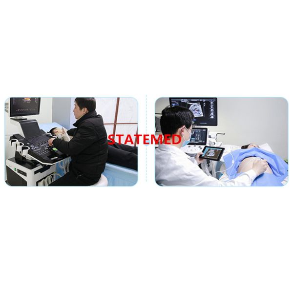 Hospital 128 E 4D Trolley Ultrasound Scanner For Women Pregnancy Diagnosis