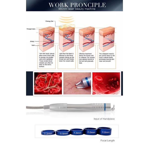 Vascular Removal 980nm Diode Laser Machine Spider Vein Red Blood Vessels Removal