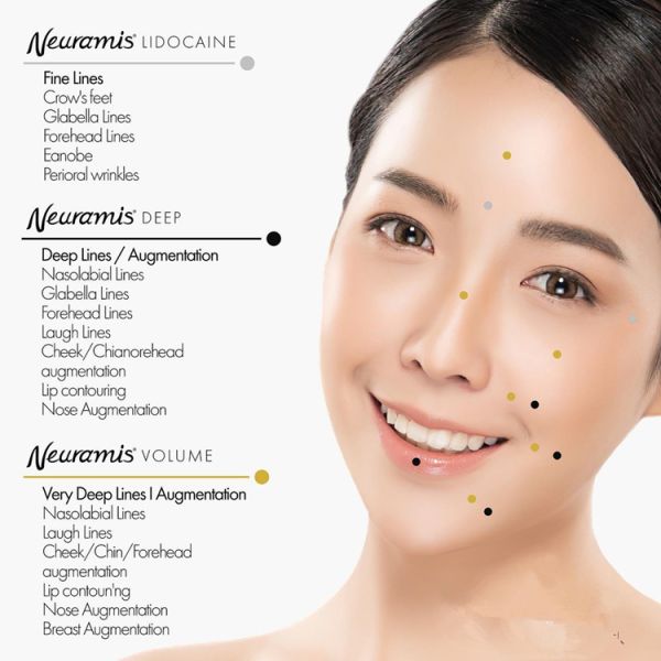 Заполнитель 1x1ml штрафа тома Neuramis заполнителей морщинки 3% Lido Hyaluronic кисловочный глубокий дермальный