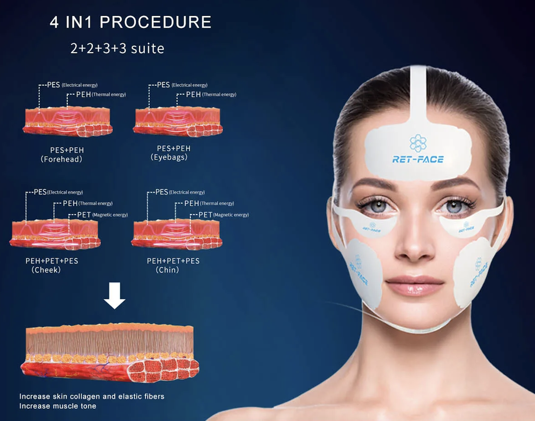 Skin Tightening Laser Beauty Machine Pe Face Vline Face Radio Frequency Electro Magnetic Therapy Machine