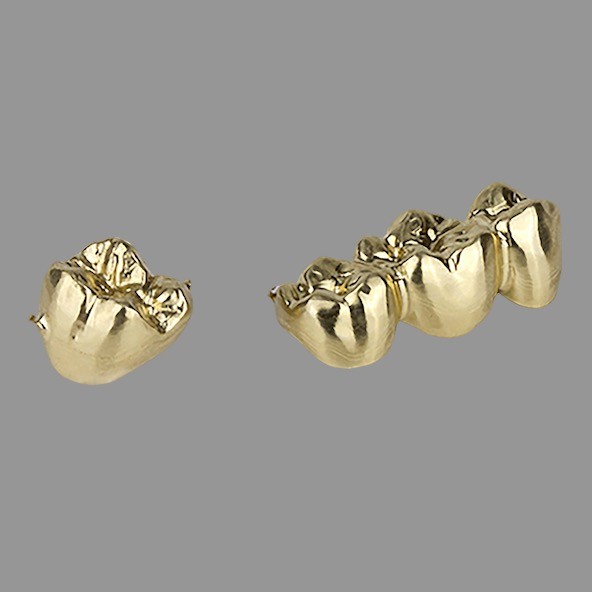 Dental Clinics Full Gold Crown Smooth Polished Wear Resistant