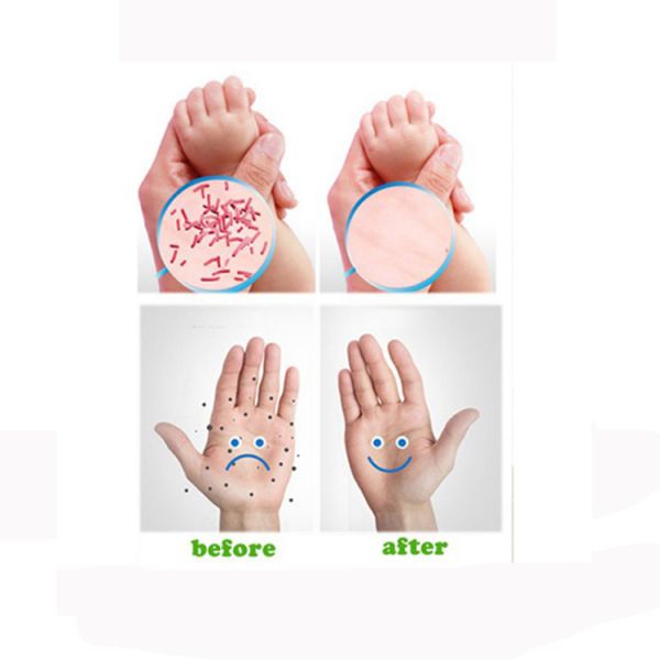 Кожа Випес обеззараживанием устранимая влажная забавляется алкоголь стерилизации чистки 75%