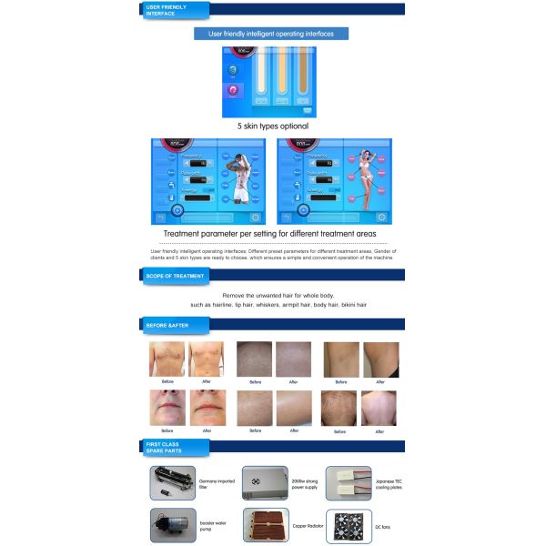 2018 hot selling big spot size 808nm diode laser hair removal system machine